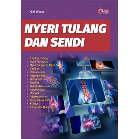 Nyeri tulang dan sendi