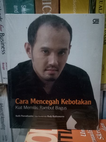 Cara Mencegah Kebotakan : Kiat Memiliki Rambut Bagus