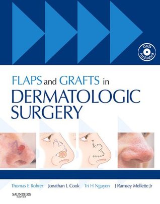 Flaps and grafts in dermatologic surgery