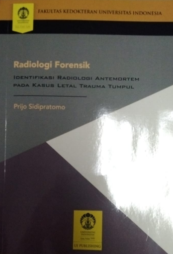 Radiologi forensik :  identifikasi radiologi antemortem pada kasus letal trauma tumpul / Prijo Sidipratomo ; editor, Dian Komala Sari, Irwan Desriana