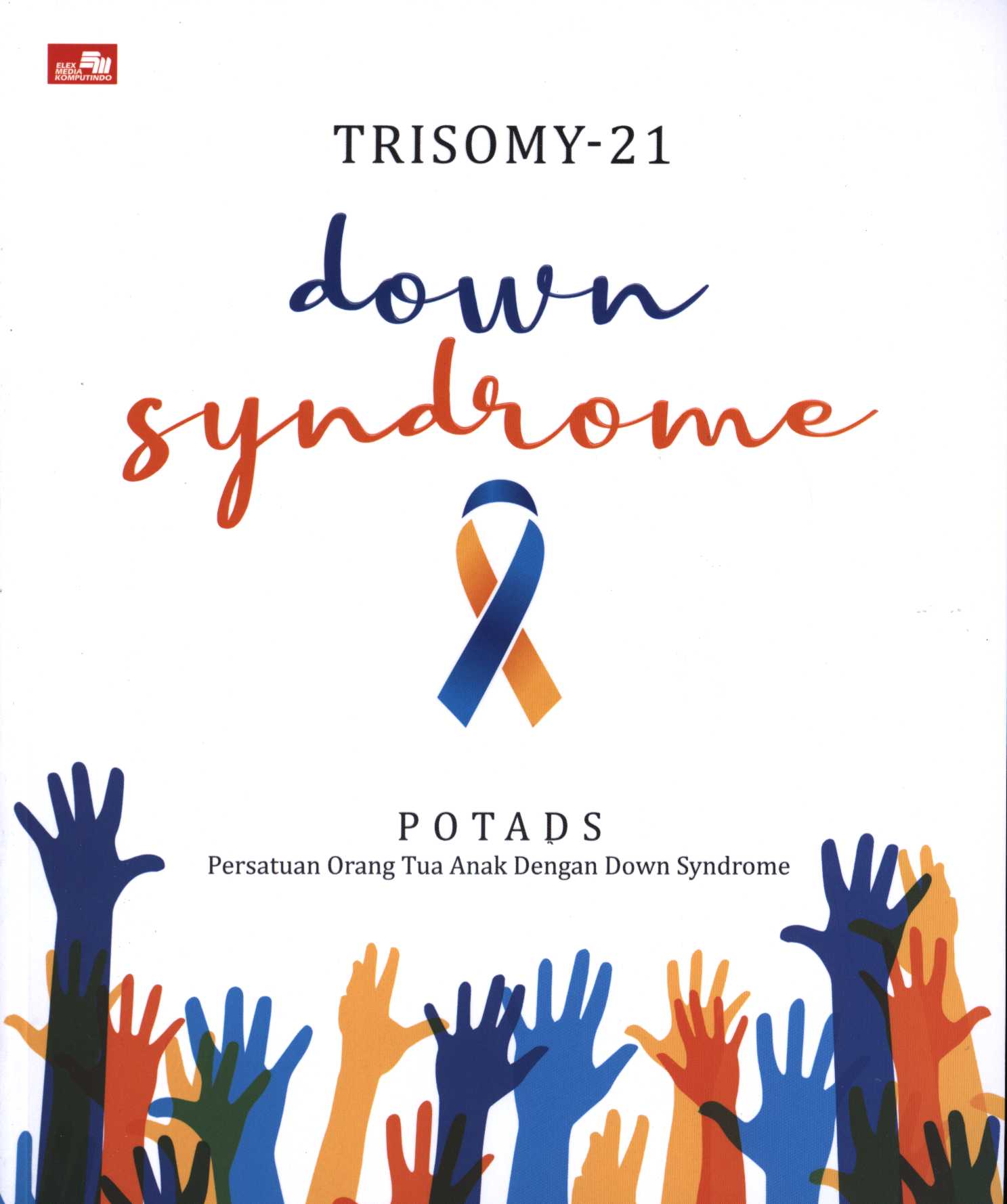 Trisomy 21 : down syndrome