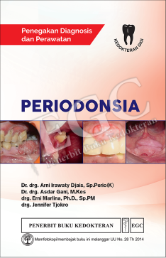 Periodonsia : penegakan diagnosis & perawatan