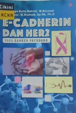 E-cadherin dan HER2 pada kanker payudara
