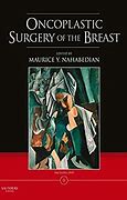 Oncoplastic Surgery Of The Breast