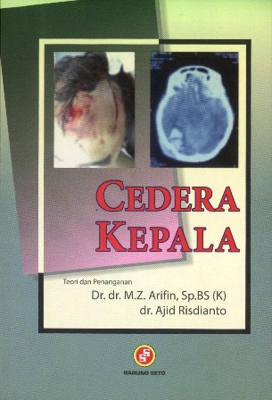 Cedera kepala