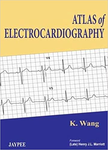 ATLAS of electrocardiography / K. Wang