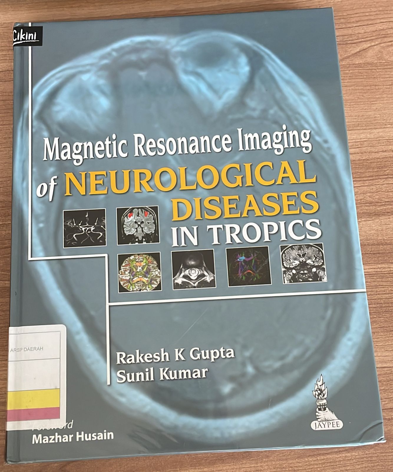 Magnetic Resonance Imaging of Neurological Diseases in Tropics