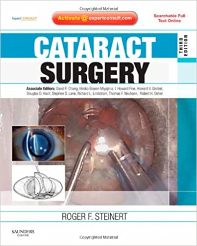 Cataract surgery