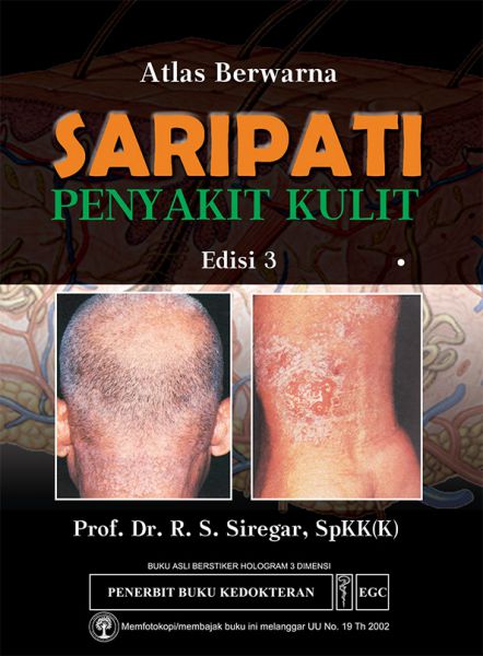 Atlas Berwarna Saripati Penyakit Kulit :  Edisi 3 / R. S. Siregar ; editor, Arcci Pradessatama