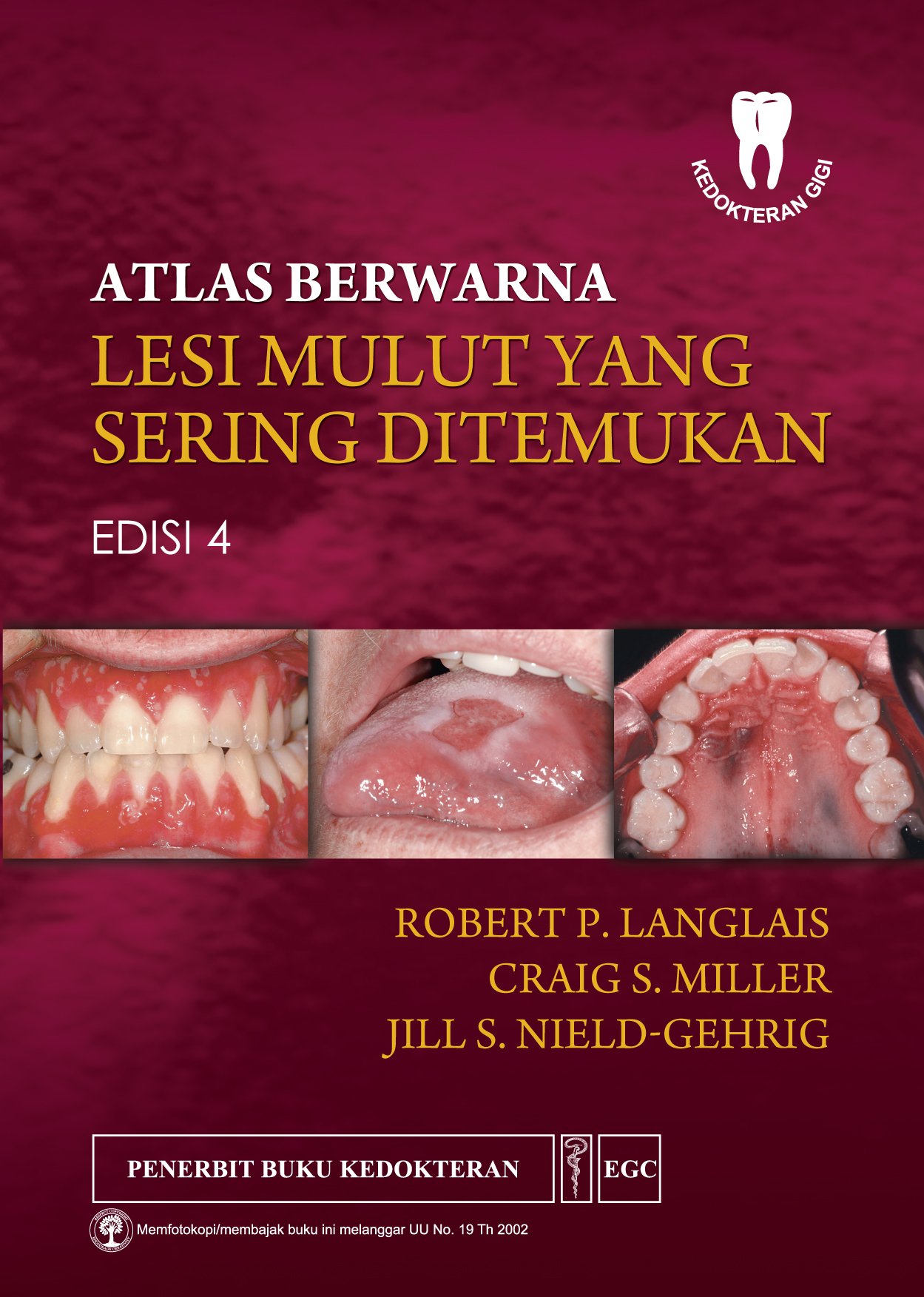 Atlas Berwarna Lesi Mulut yang Sering Ditemukan / Robert P. Langlais