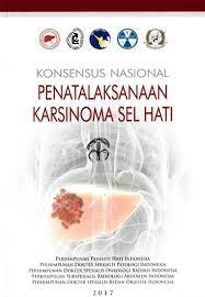 Konsensus Nasional Penatalaksanaan Karsinoma Sel Hati